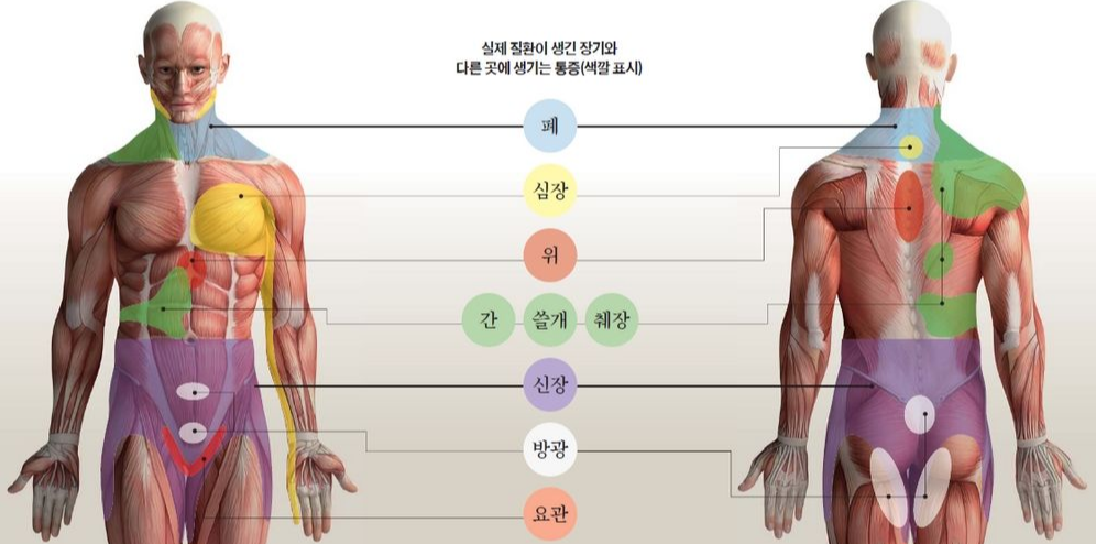 췌장암 등통증