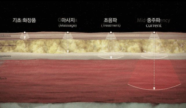 김희선 마사지기 원리