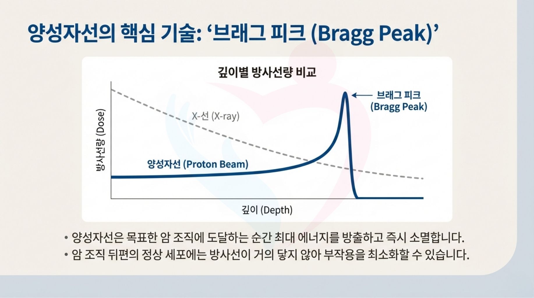 일본 중부국제의료센터 양성자치료 최신장비 ProBeam360