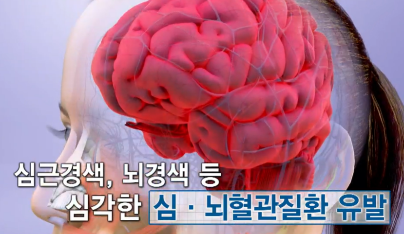 콜라겐 부족 증상