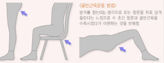 요실금 치료방법 2