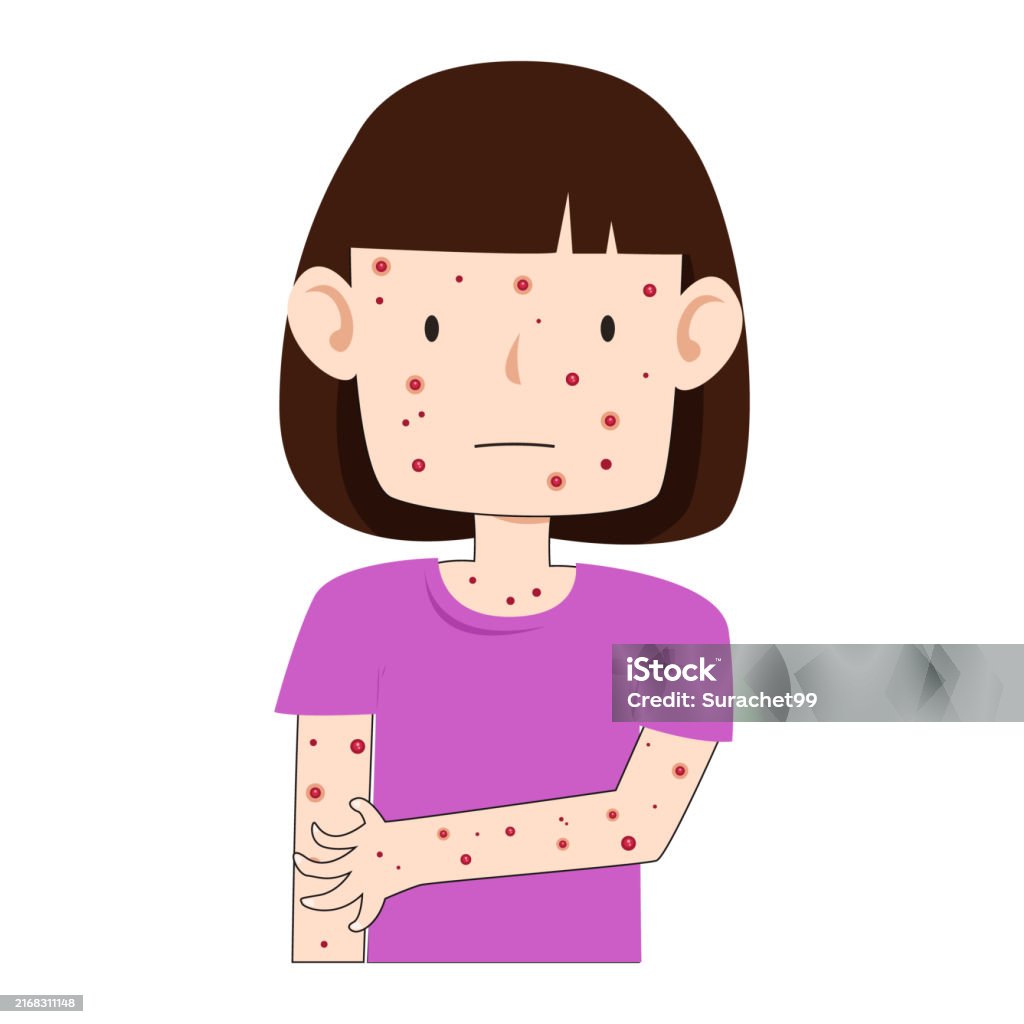 유아 피부감염 관련 사진