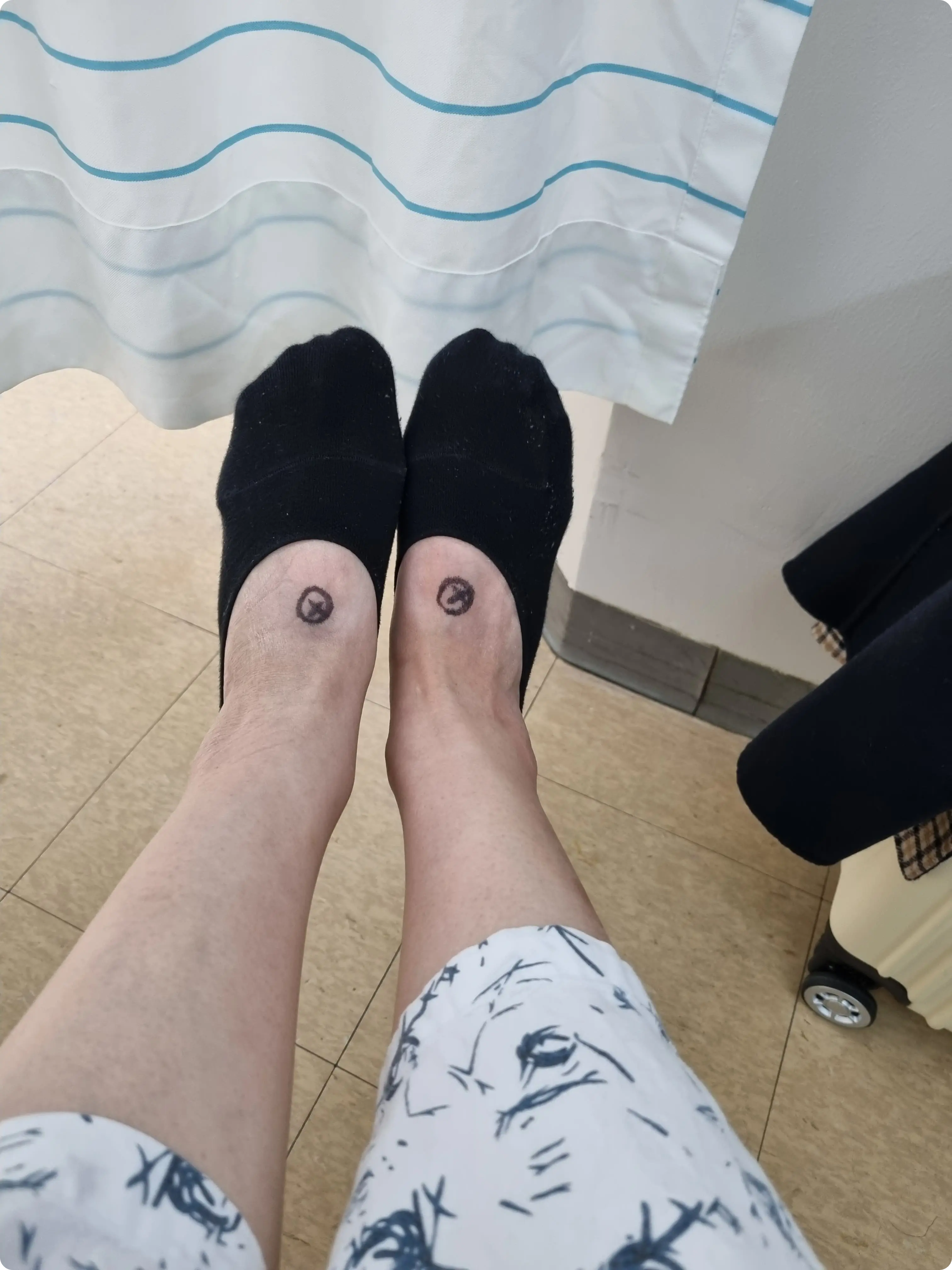 서울 아산병원 입원 후 과정