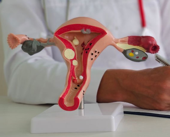 여성 건강 이해