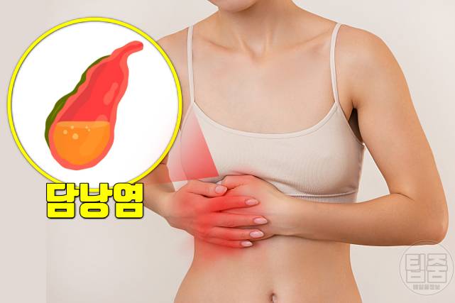 우루사 효능 간영양제 udca 효과 급성담낭염