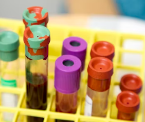 폐경기 검사 방법