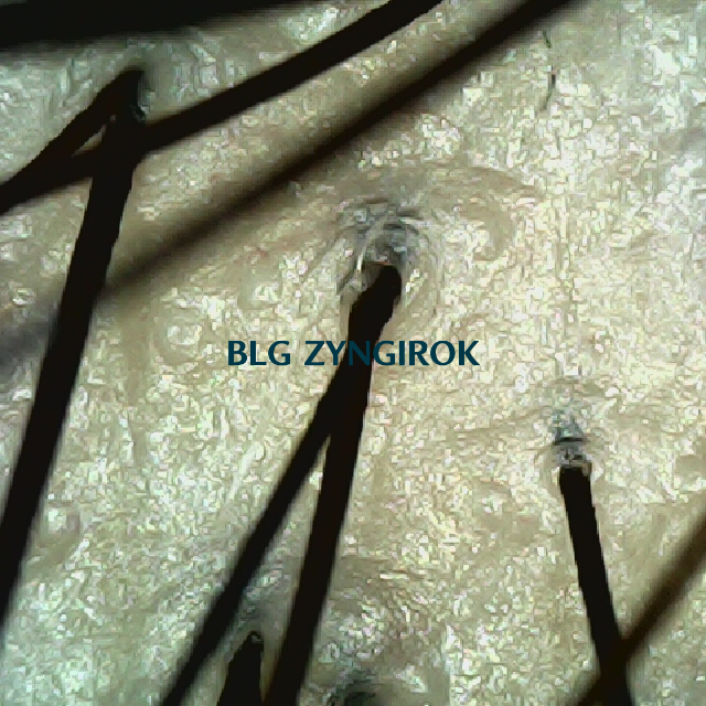 탈모 극복 프로젝트 - 정수리 두피모습이다.