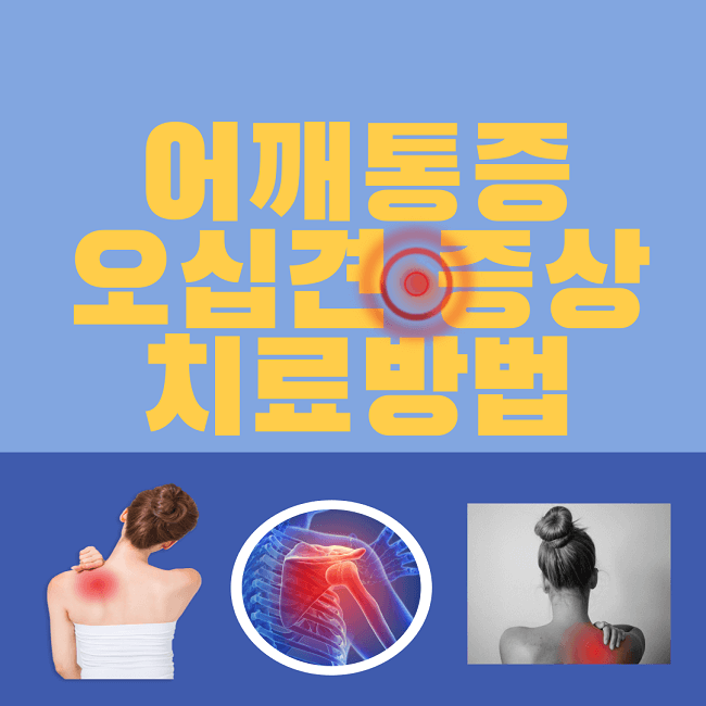 어깨통증을 유발하는 오십견 증상과 치료방법 썸네일