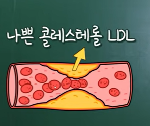 고지혈증 약의 효과