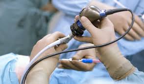 대장내시경 비용 총정리