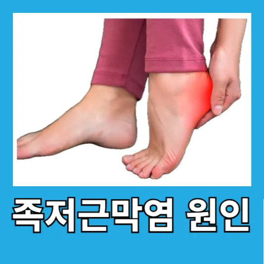 족저근막염 원인
