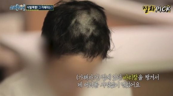 여자친구를 감금하고 바리캉으로 머리를 미는 등 수 차례 폭행&middot;성폭행한 남성이 1심 판결 전 법원에 억대 공탁금을 걸었다. 위 사진은 피해자가 2023년 8월 10일 방송된 MBC '실화탐사대'를 통해 피해 사실을 알리는 모습. [사진=MBC '실화탐사대' 방송화면 캡처]
