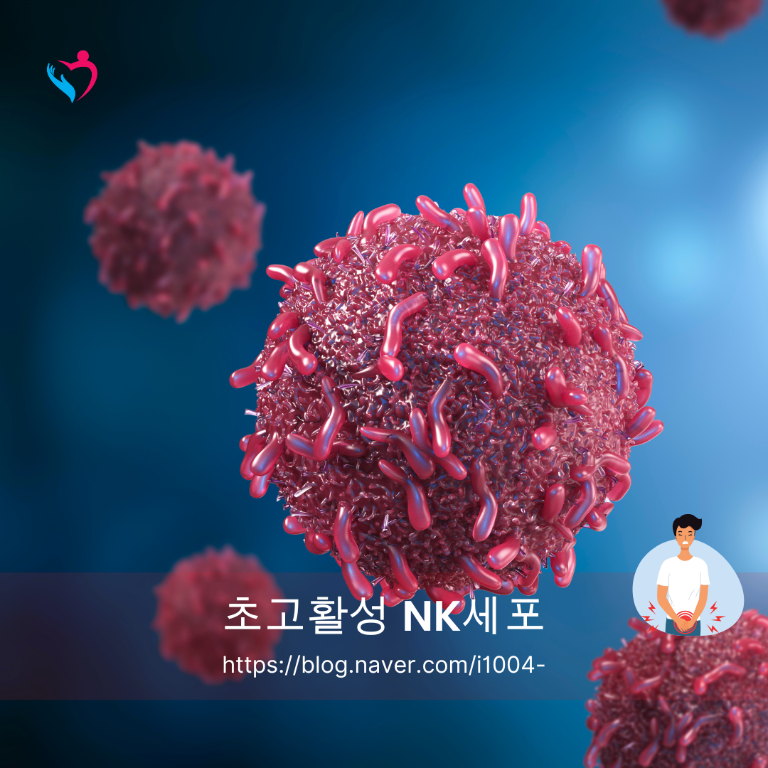 NK세포 암 예방 일본 치료에 대하여
