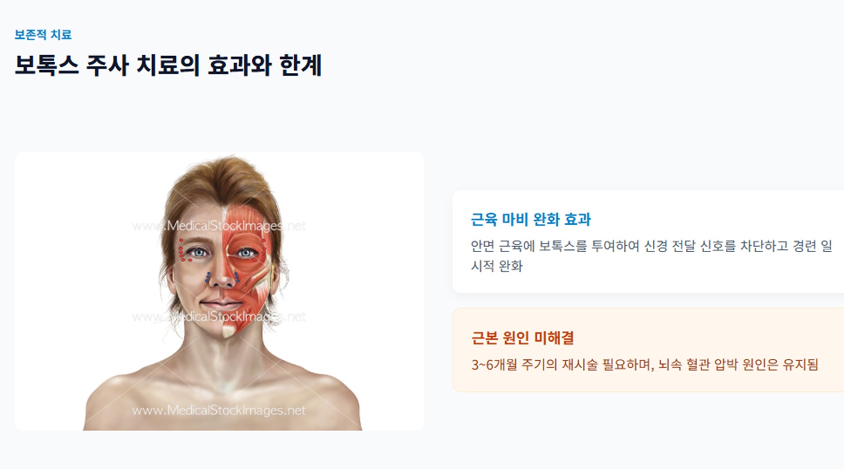 보톡스주사