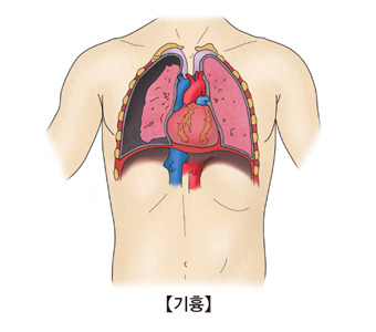 기흉 증상&middot;원인&middot;치료 - 갑자기 숨쉬기 힘들다면