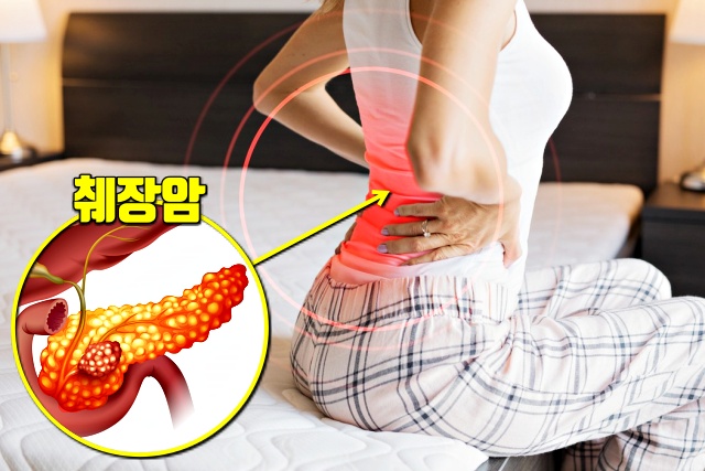 허리통증, 등통증, 놓치기 쉬운 암 증상 7가지, 췌장암 증상 원인, 건강, 팁줌 매일꿀정보