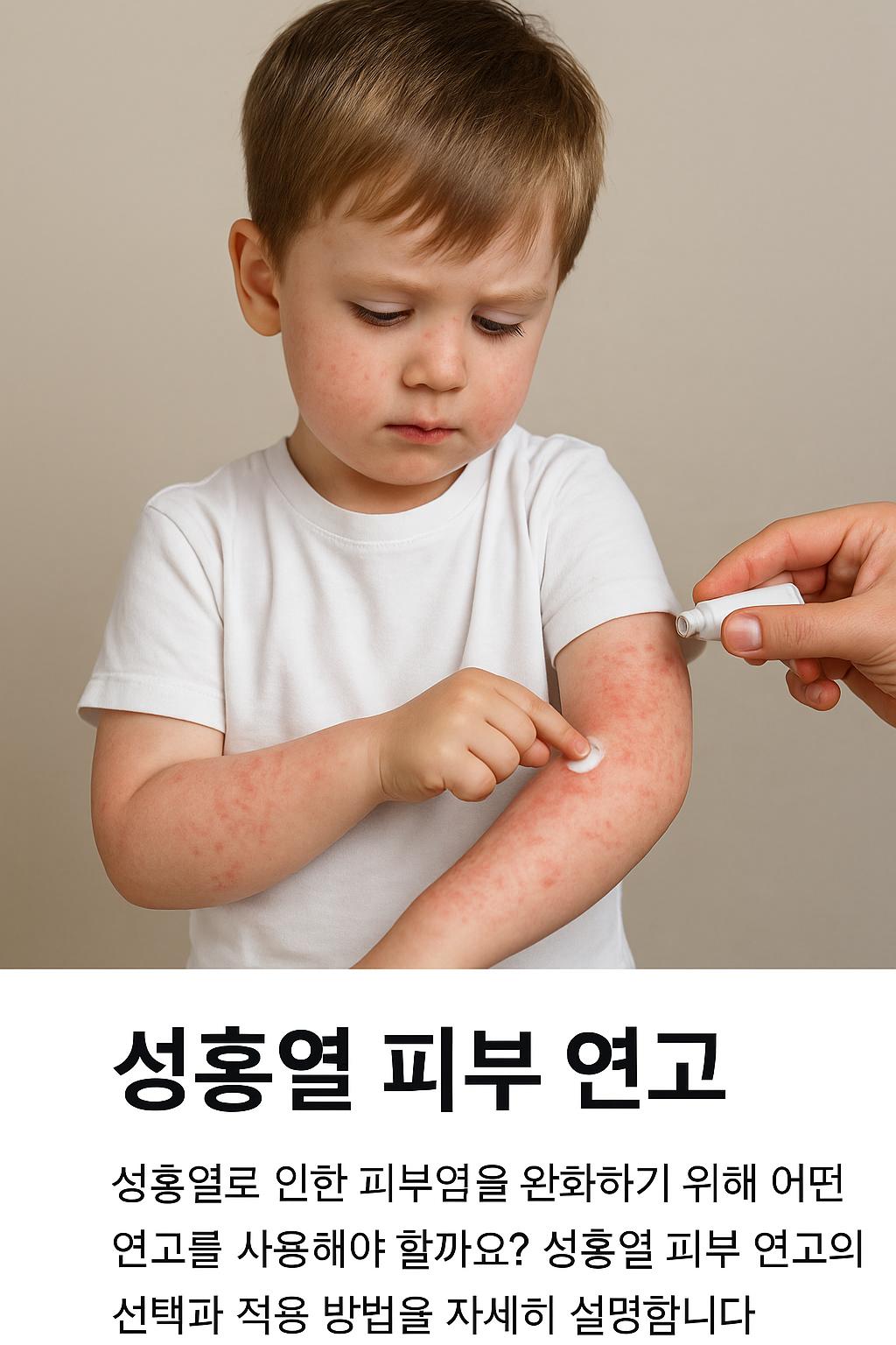 성홍열 피부 연고