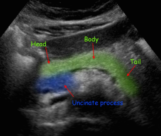 정상췌장의 초음파적 소견