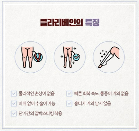 하지정맥류 치료 방법