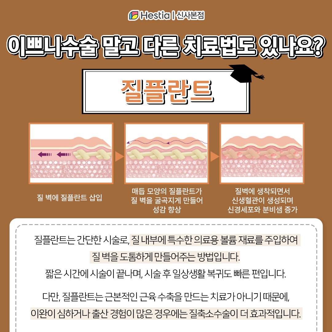 질수술 말고 다른 치료법은요?