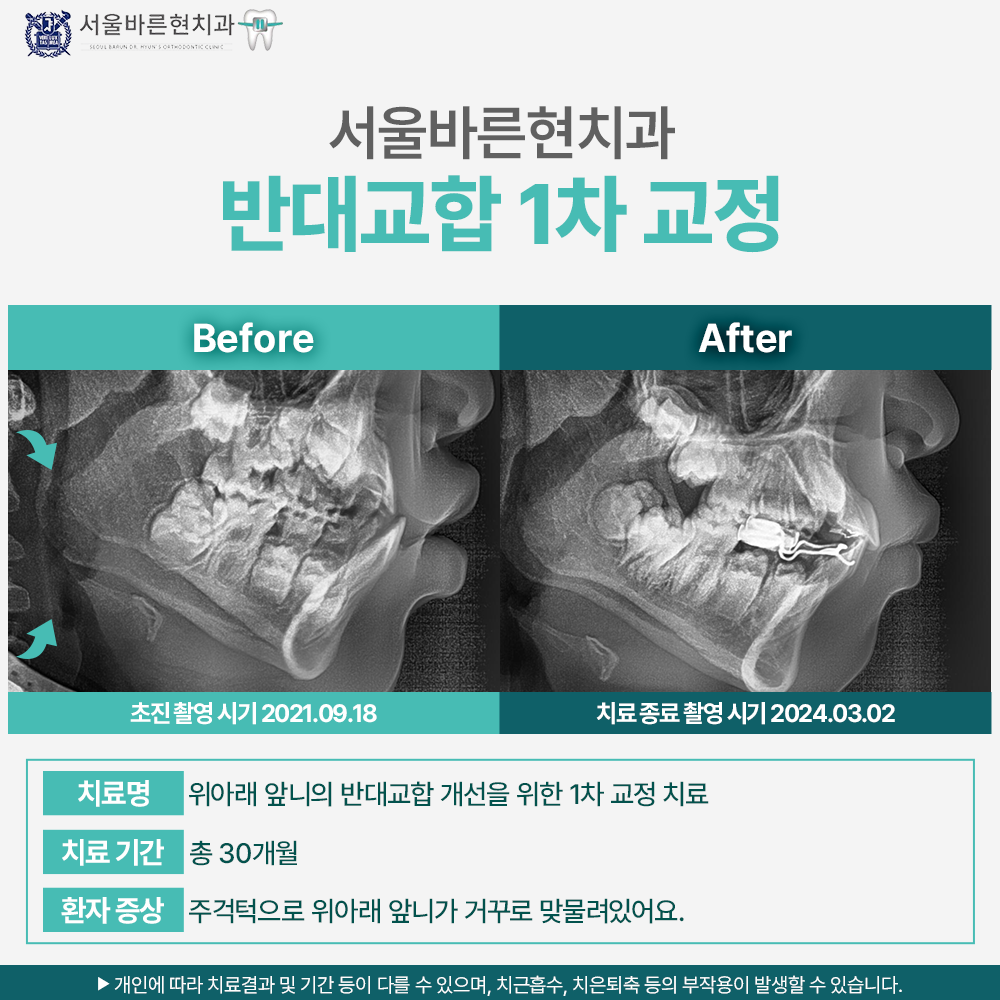 부산치아교정치과