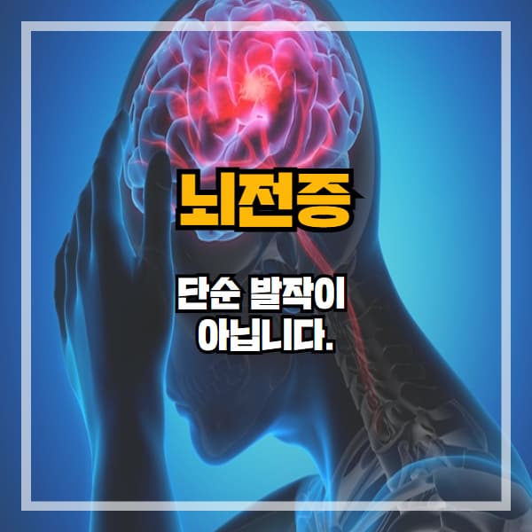 뇌전증, 단순 발작이 아닙니다. 반드시 알아야 할 사실