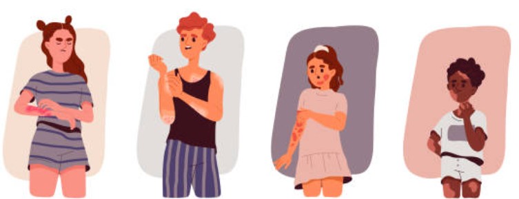 아토피 피부염 관리법과 주의사항 (보습, 식이, 환경조절)