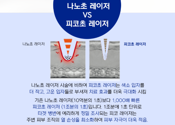 아이라인 제거