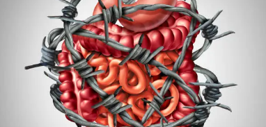 과민성 대장 증후군 증상