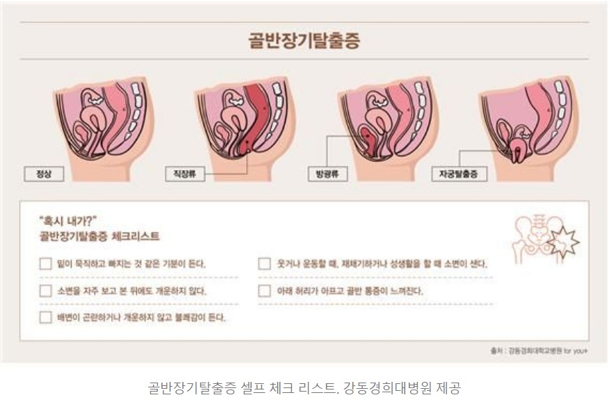 체크리스트