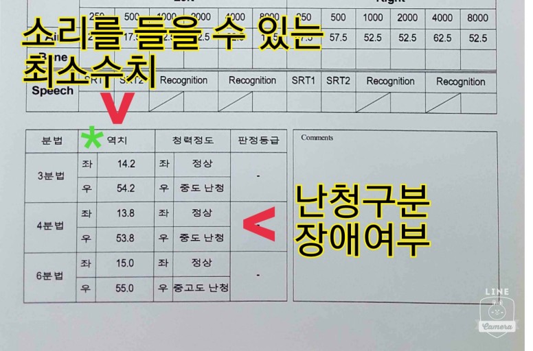 보청기: 청력 보조 기기에 대한 무조건 알아야 할 모든 것