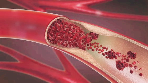 니코틴산 고지혈증약