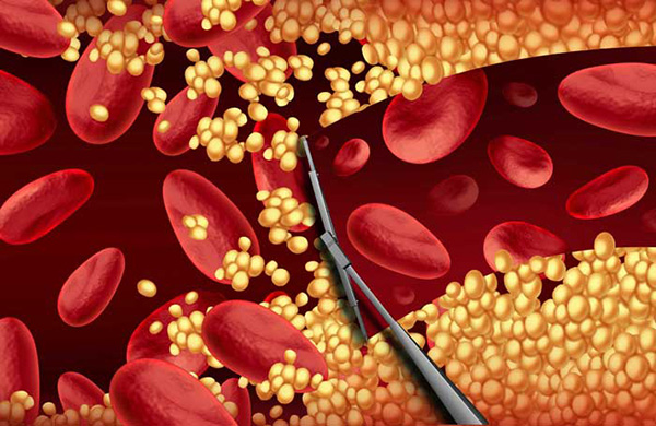 모더나백신부작용/