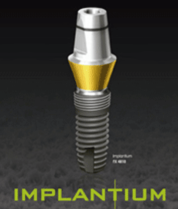 부산-강서구-임플란트잘하는곳-저렴한곳