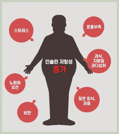 인슐린 저항성
