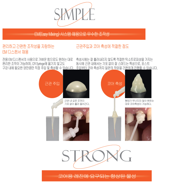 코어용 레진에 요구되는 향상된 물성