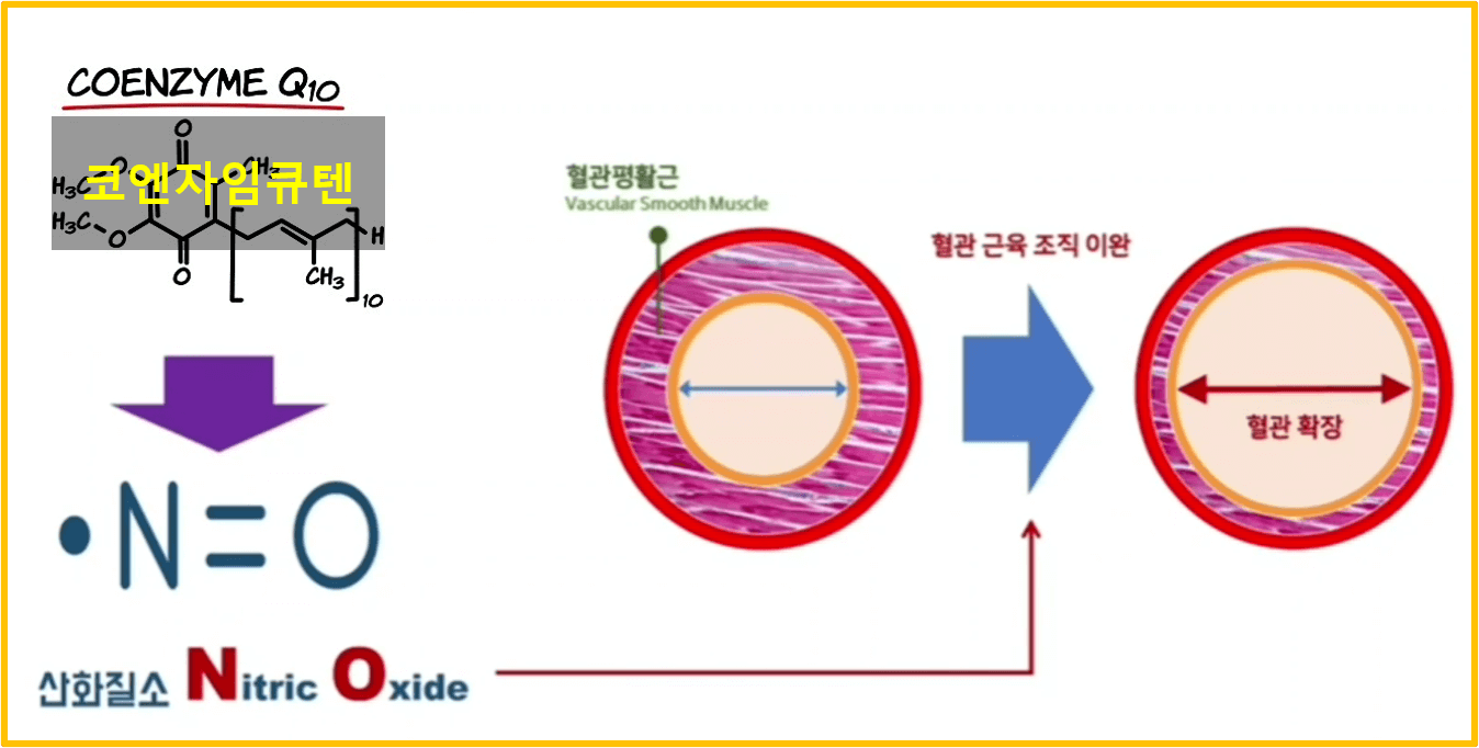 고혈압