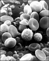  Monocyte 수치