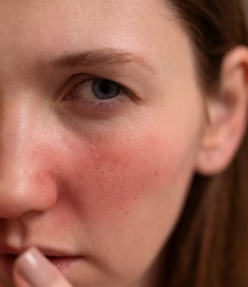 피부가려움증의 원인 9