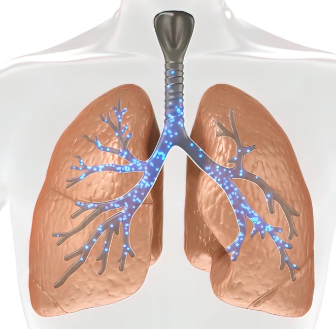 기관지 천식 증상과 원인 그리고 생활 속 예방법
