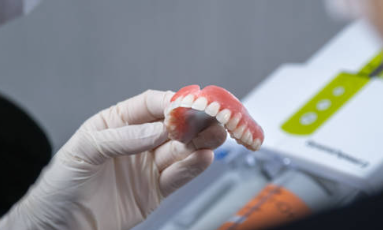 오스템 임플란트 가격, 종류