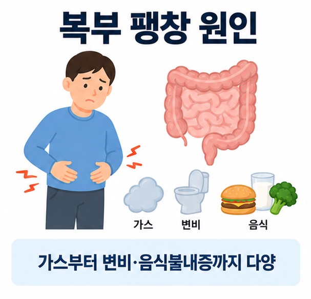 복부 팽창 원인이라는 제목과 복부 가스, 장, 변비, 음식 아이콘을 함께 표현한 대표 이미지
