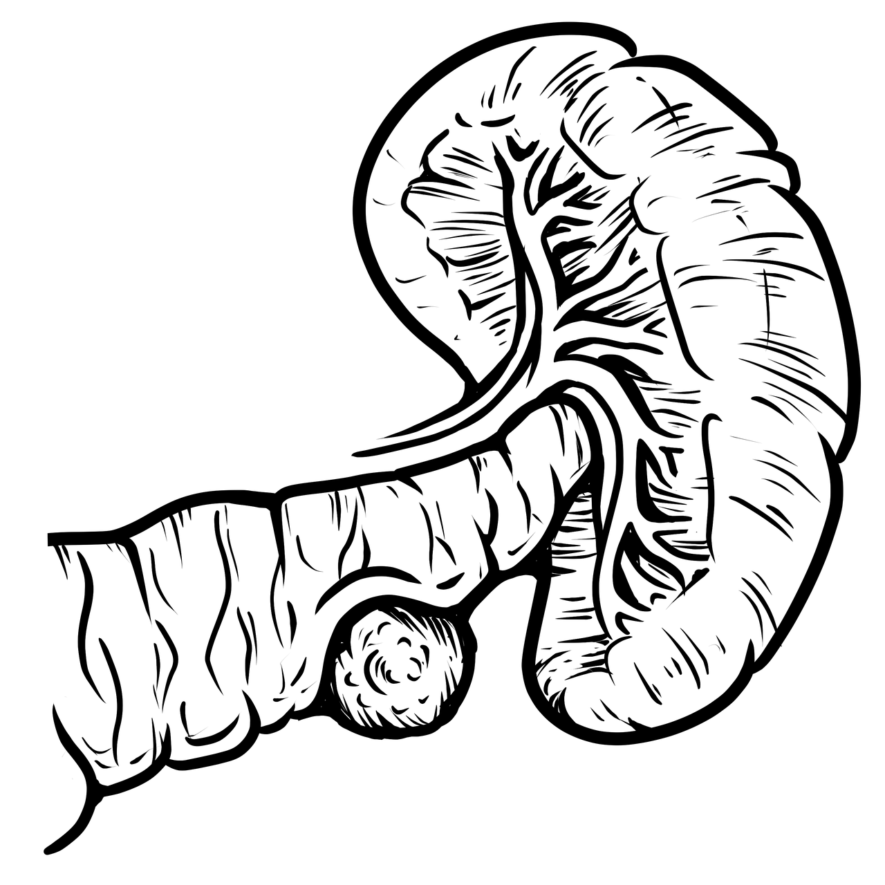 췌장