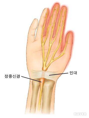 손목 인대 그림