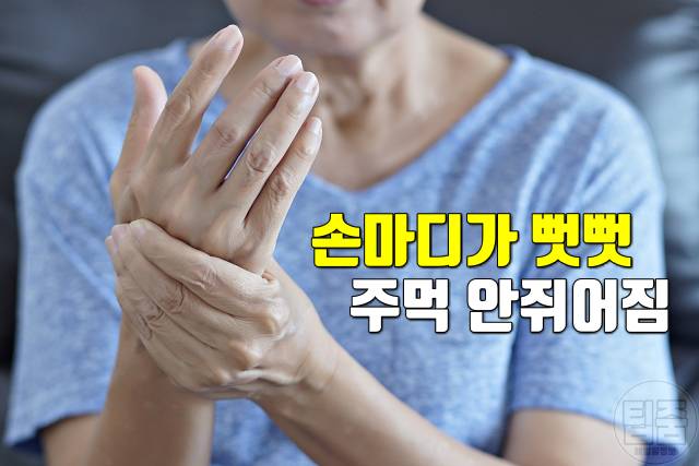 류마티스 관절염 초기 증상 자가진단 손마디 뻣뻣
