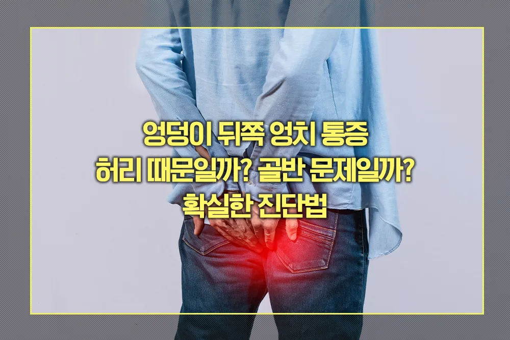 엉덩이 뒤쪽 엉치 통증 진단법