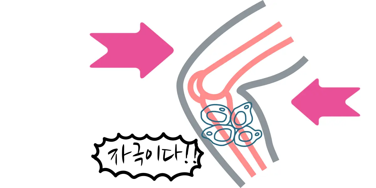 걷기운동-골밀도