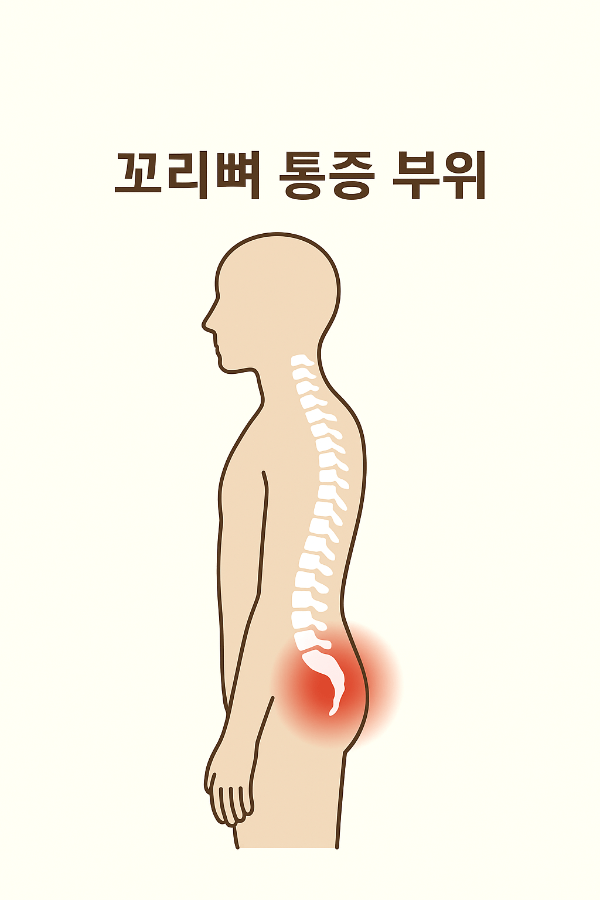 꼬리뼈 통증부위 출처/쳇지피티