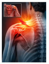 40대 어깨 결림 이유