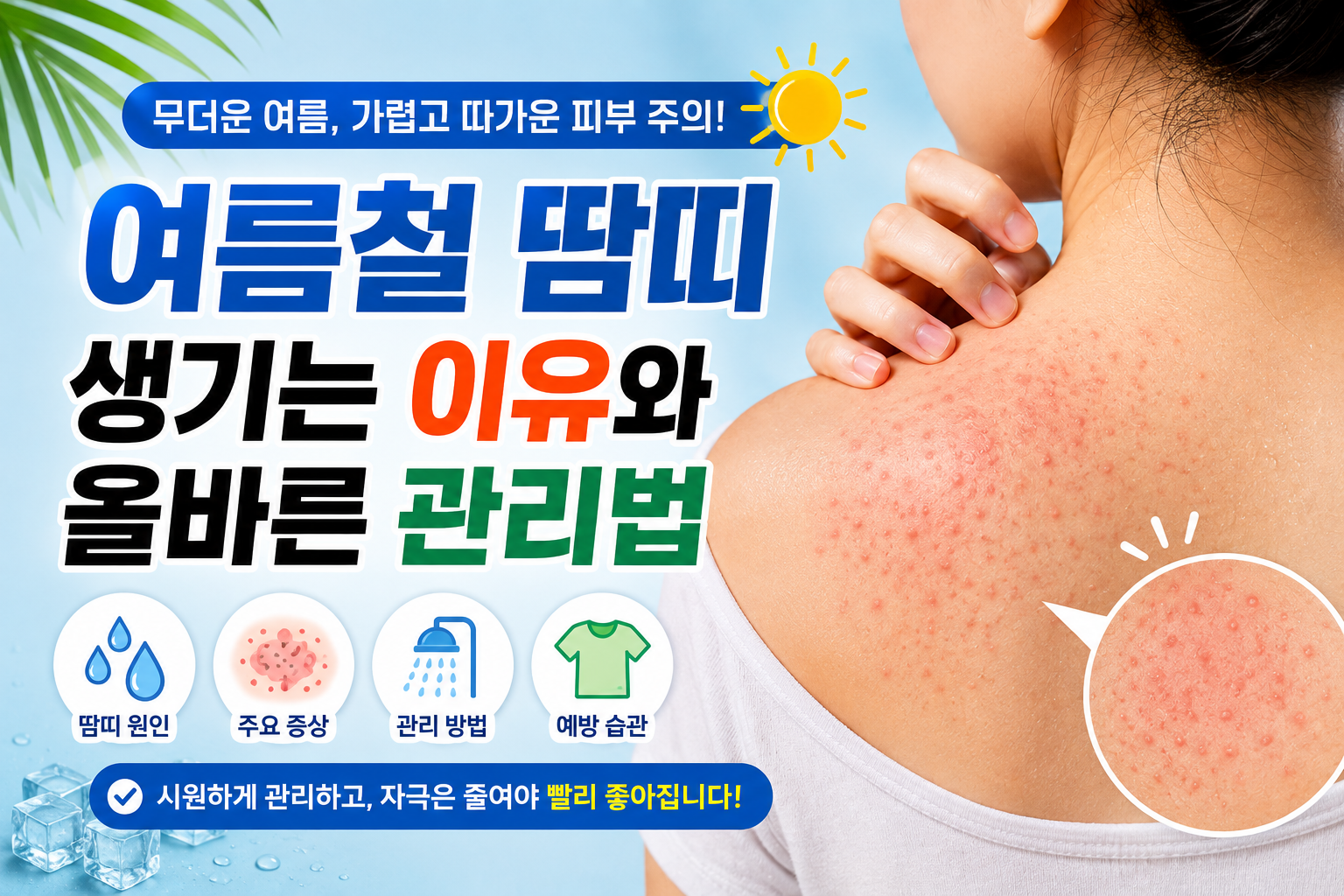 여름철 땀띠 생기는 이유와 올바른 관리법